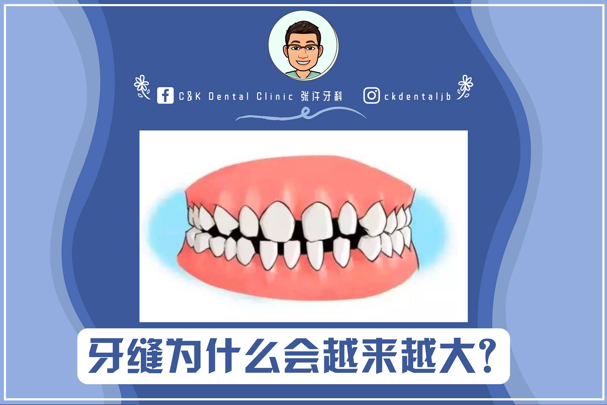 Wisdom Tooth Wisdom Tooth