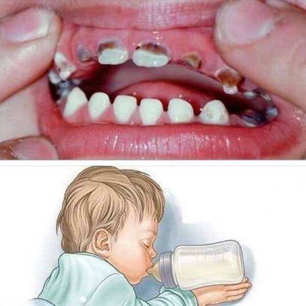 Baby Teeth