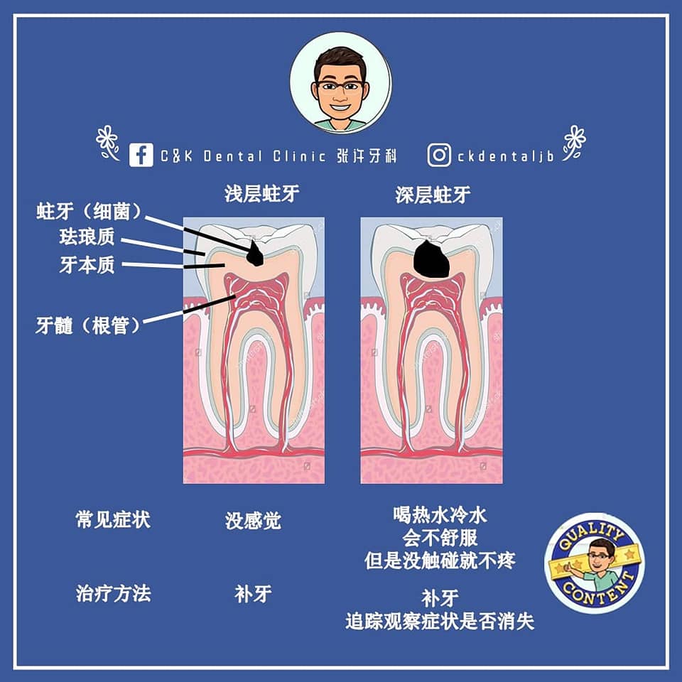 Wisdom Tooth