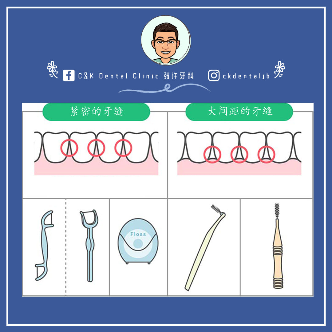 Wisdom Tooth