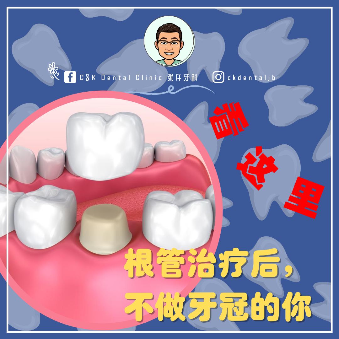 Wisdom Tooth