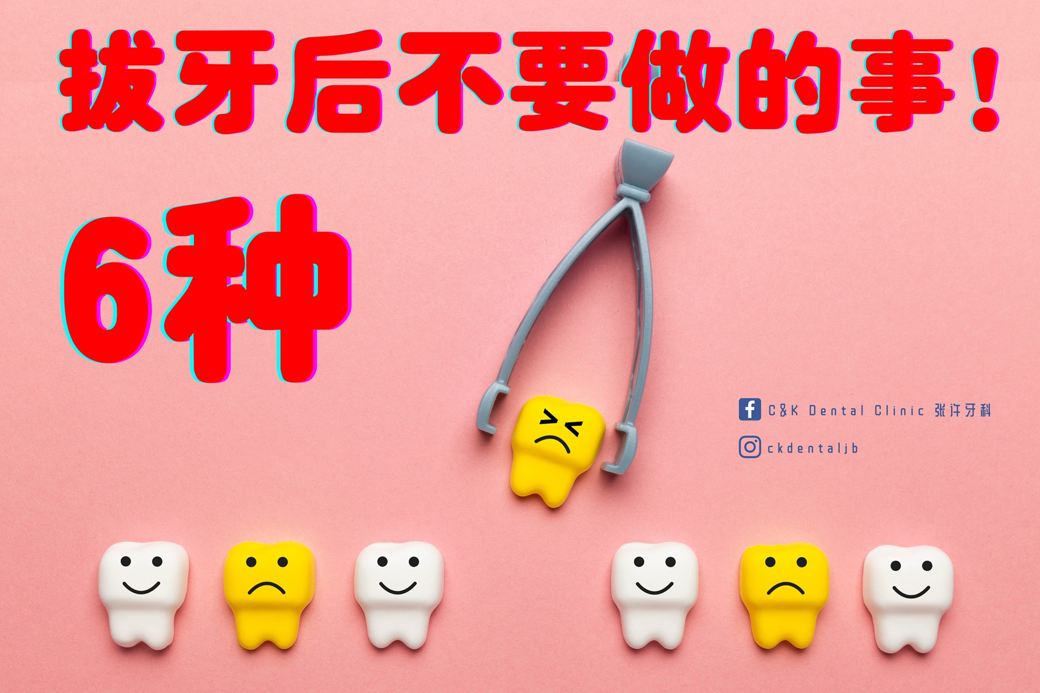 Wisdom Tooth