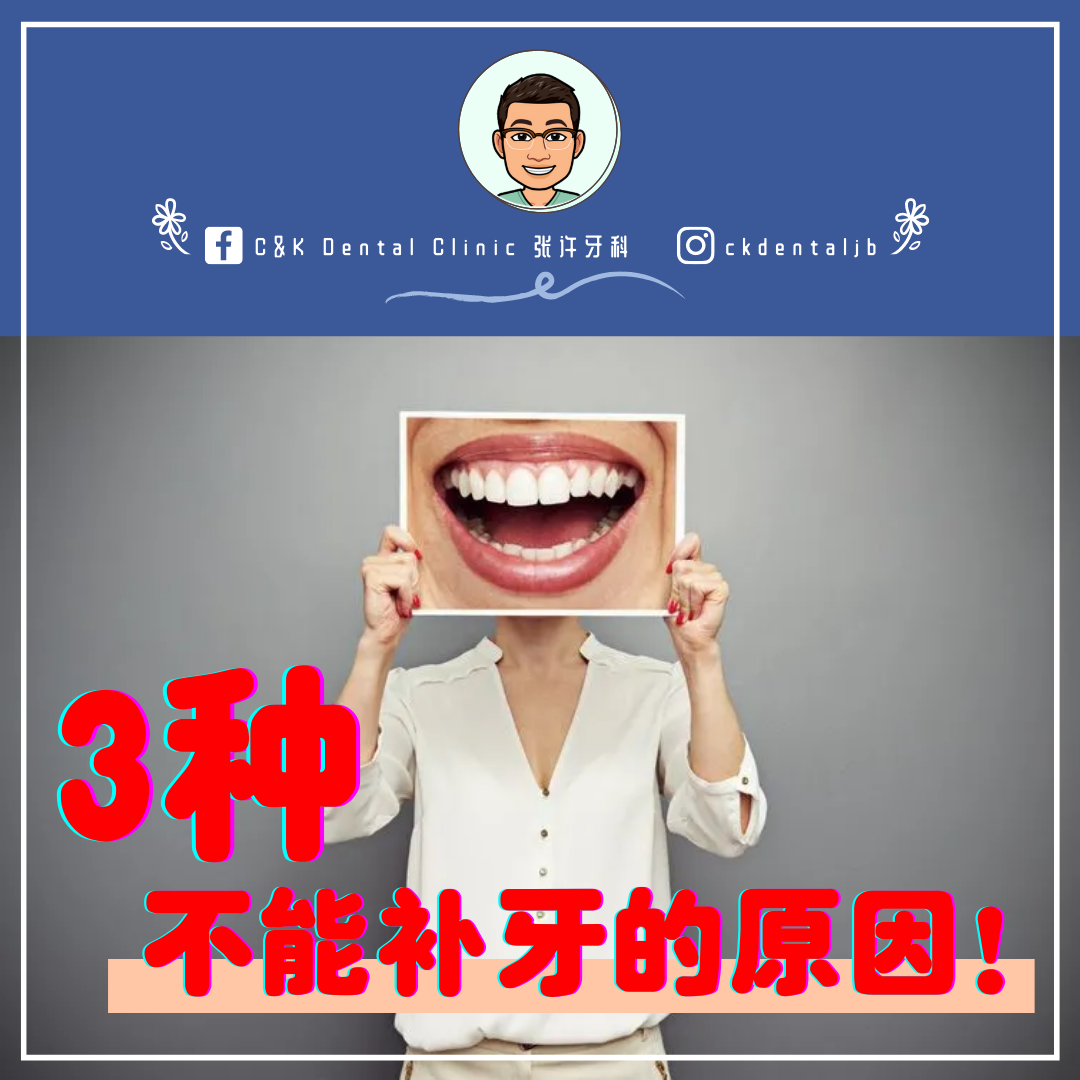 Wisdom Tooth