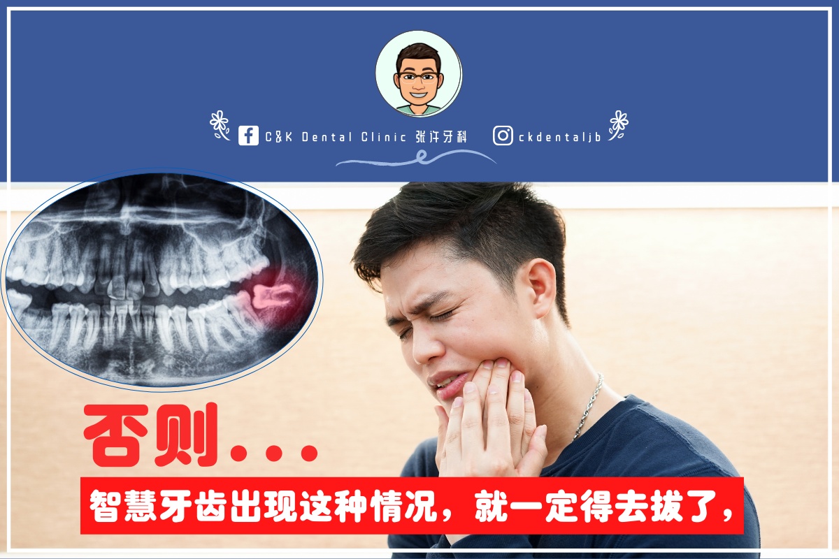 Wisdom Tooth