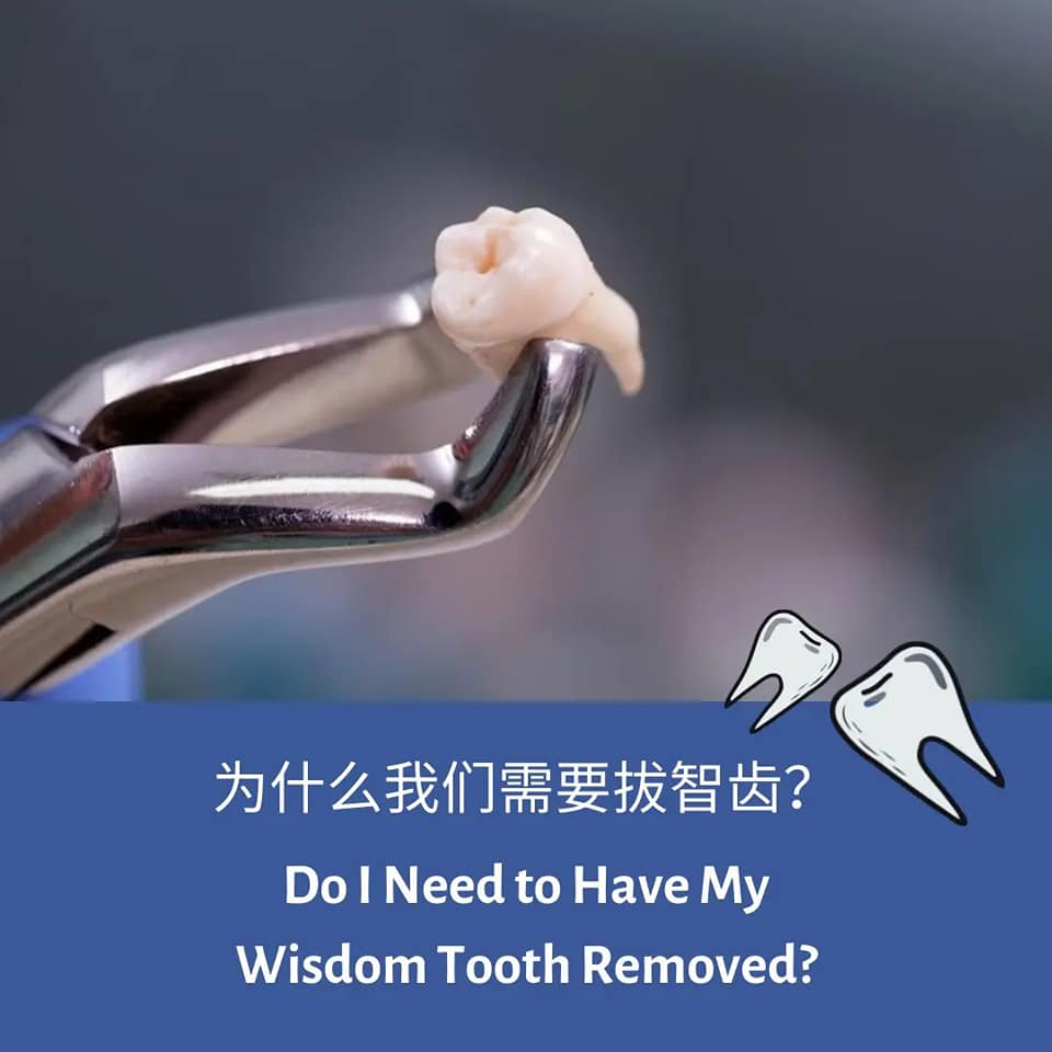 Wisdom Tooth