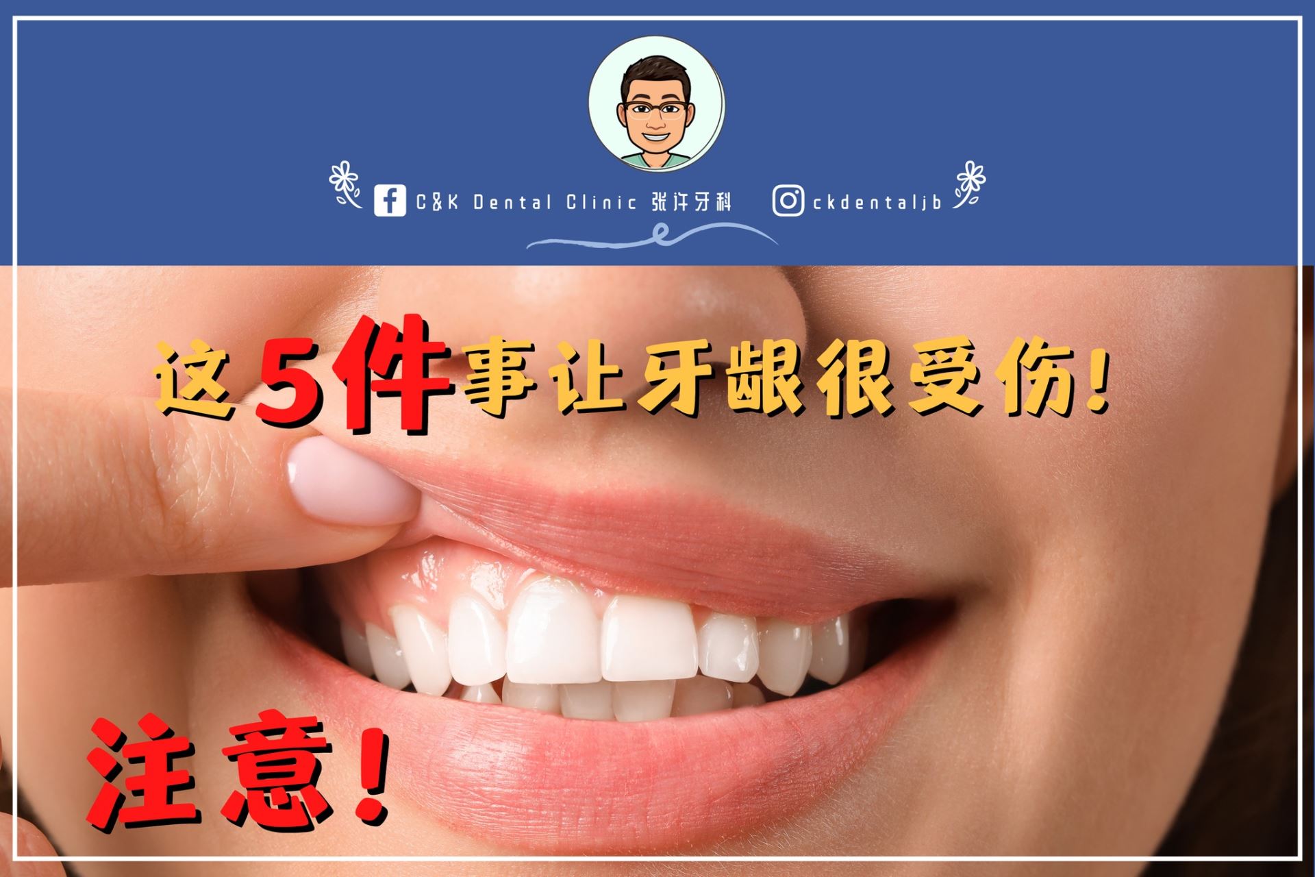 Wisdom Tooth