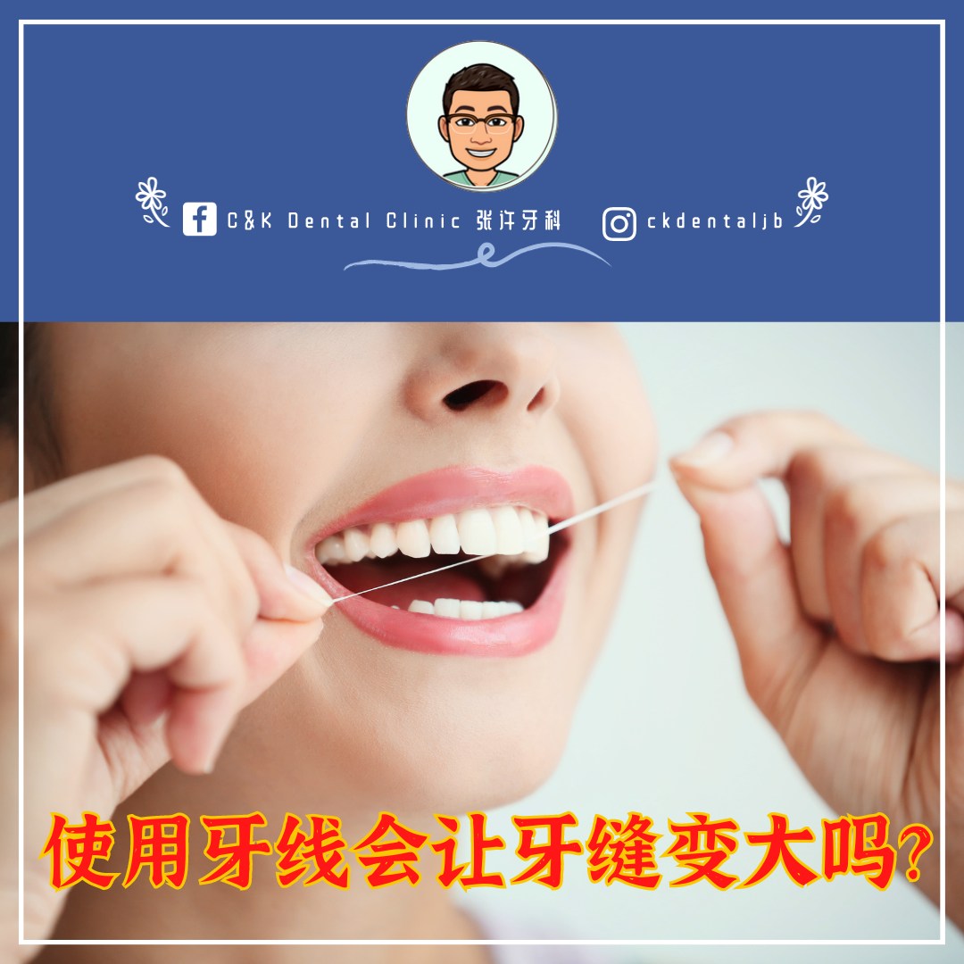 Wisdom Tooth