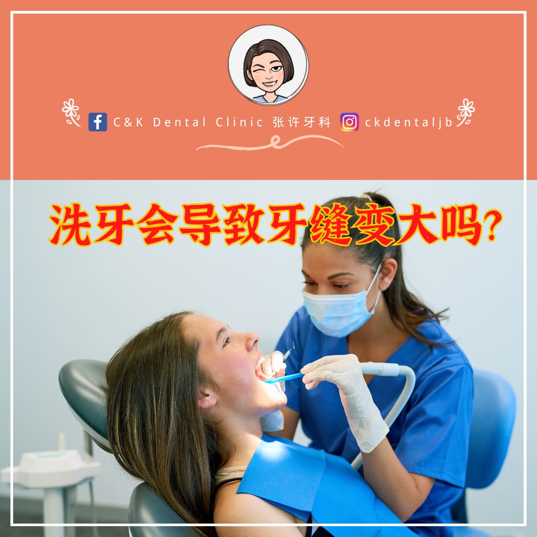Wisdom Tooth