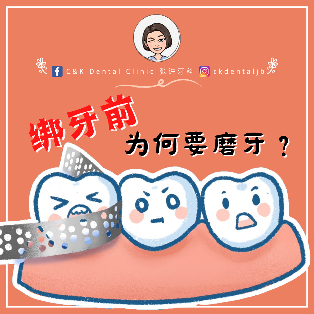 Wisdom Tooth